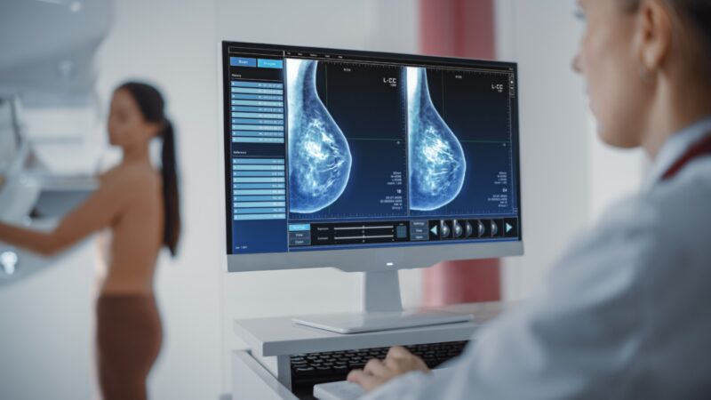 Senado Federal aprova projetos que reduzem para 30 anos a idade mínima para realização de mamografia