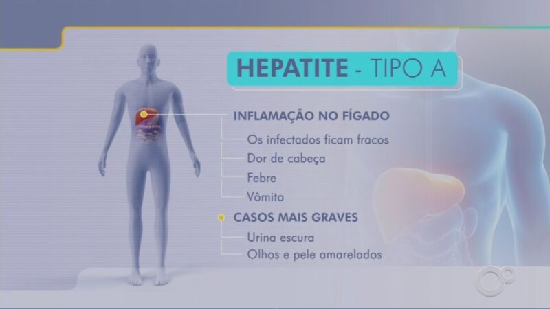 Casos de hepatite A aumentam 54,5% em 2024 no Brasil, diz Ministério da Saúde