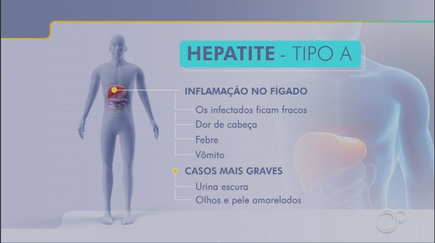 Casos de hepatite A aumentam 54,5% em 2024 no Brasil, diz Ministério da Saúde